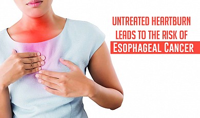 esophageal cancer treatment